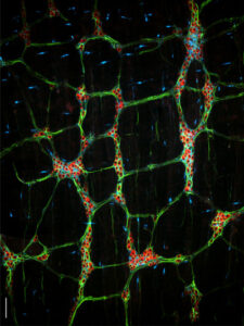 neurones