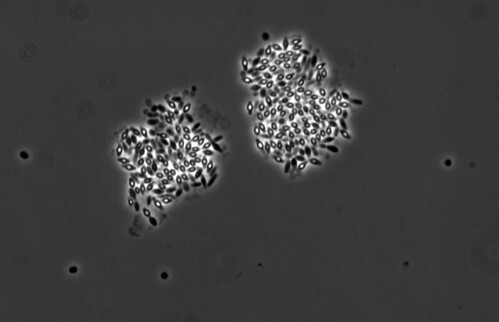 Des bactéries résistantes infectées par des virus bactériens