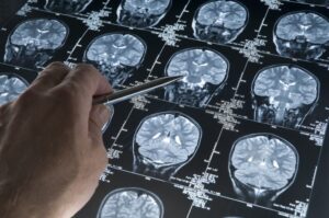Scanner à résonance magnétique de cerveau tête crâne et os avec Main pointant du doigt